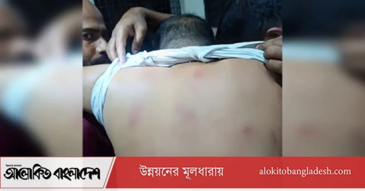 সিরাজগঞ্জে হাতুড়িপেটা করে তেল ব্যবসায়ীর ৭ লাখ টাকা ছিনতাই