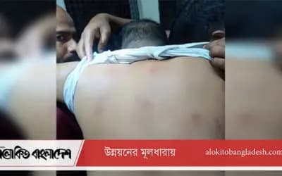 সিরাজগঞ্জে হাতুড়িপেটা করে তেল ব্যবসায়ীর ৭ লাখ টাকা ছিনতাই