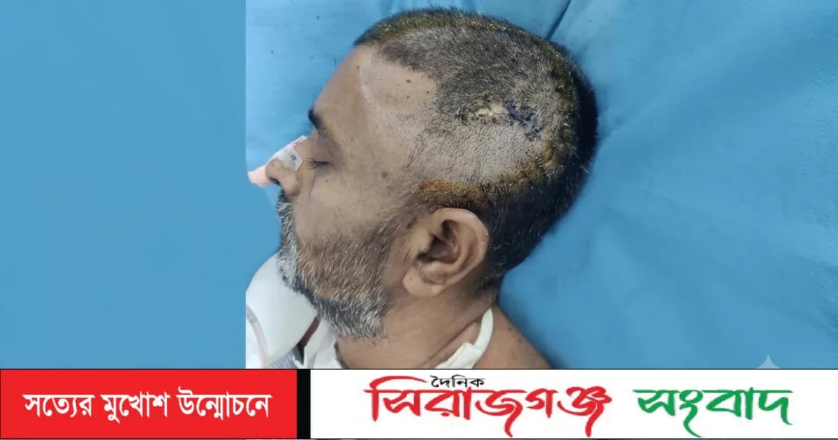 ‎গাজিপুরের কালিকৈরে সন্ত্রাসীদের হামলায় আহত আজিবরের মৃত্যু !