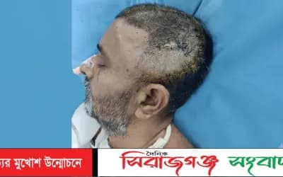 ‎গাজিপুরের কালিকৈরে সন্ত্রাসীদের হামলায় আহত আজিবরের মৃত্যু !