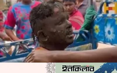 শাহজাদপুরে বায়োপ্লান্ট বিস্ফোরণে দগ্ধ ২ জন