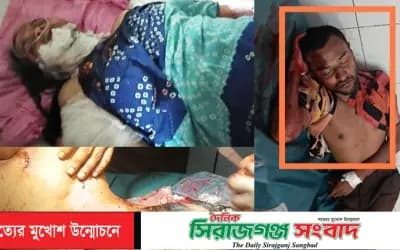 মাদকাসক্ত ছেলের ধারালো বঁটির কোপে মা ও ভাই গুরুতর আহত,গ্রেফতার ১