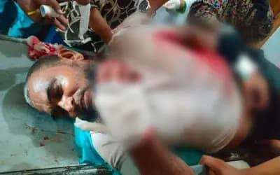 লং মার্চ শেষে সিরাজগঞ্জে জামায়াত নেতাকে কুপিয়ে জখমের অভিযোগ