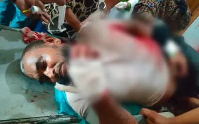 লংমার্চ শেষে সিরাজগঞ্জে জামায়াত নেতাকে কুপিয়ে জখমের অভিযোগ | সারাদেশ | বাংলা এডিশন