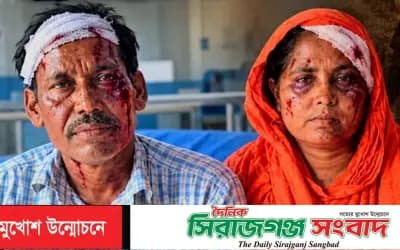 আইফোন দিতে অস্বীকৃতি, চাঁদা দাবির অভিযোগে প্রবাসীর বাবা-মাকে পিটিয়ে রক্তাক্ত