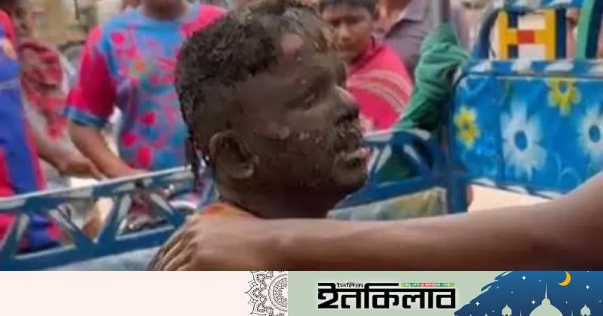 শাহজাদপুরে বায়োপ্লান্ট বিস্ফোরণে দগ্ধ ২ জন