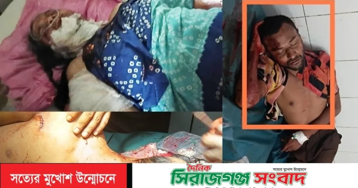মাদকাসক্ত ছেলের ধারালো বঁটির কোপে মা ও ভাই গুরুতর আহত,গ্রেফতার ১