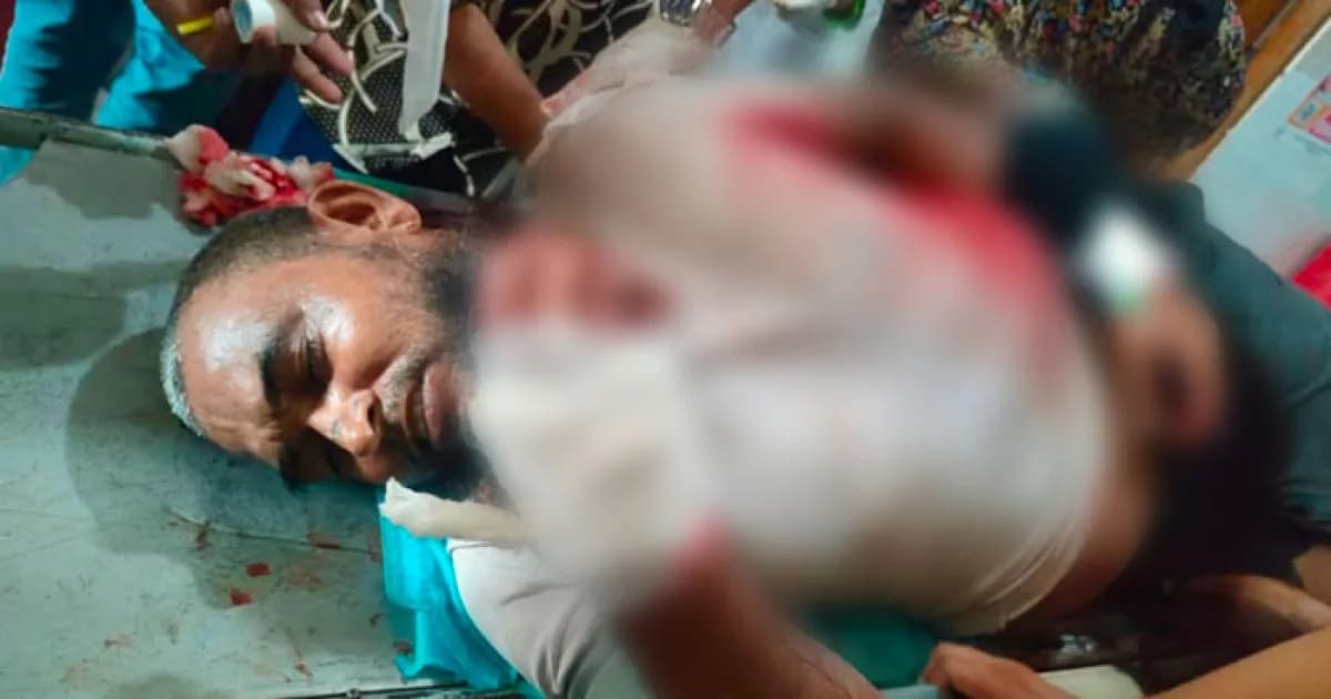 লং মার্চ শেষে সিরাজগঞ্জে জামায়াত নেতাকে কুপিয়ে জখমের অভিযোগ