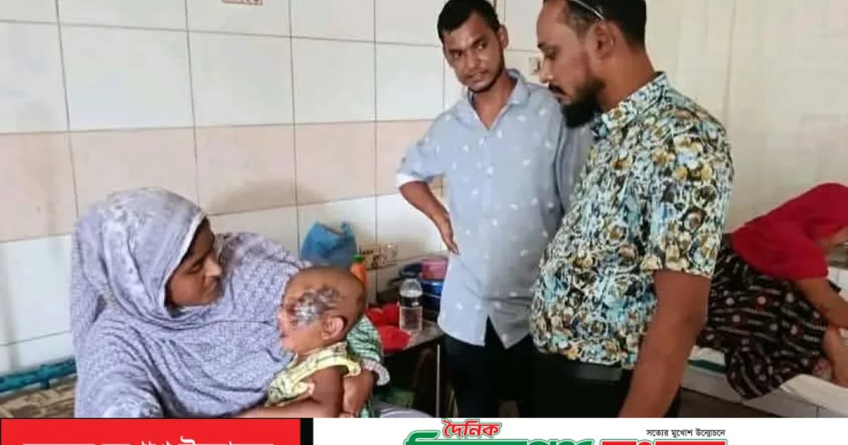 সড়ক দুর্ঘটনায় আহত নাঈমের সন্তানকে হাসপাতালে দেখতে গেলেন যুবদল নেতা রাকিব